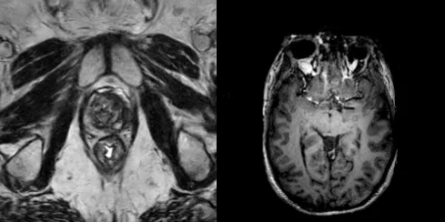 Figure shows Generated MR images using NV-Generate-CTMR rflow-mr model

