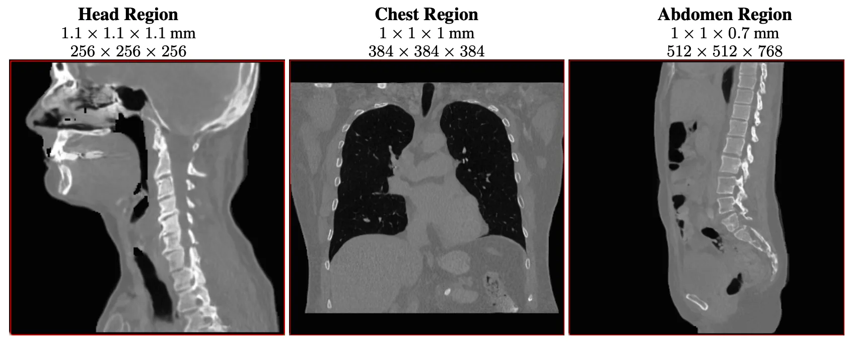 Figure shows generated CT images aren’t limited to a single organ or configuration
