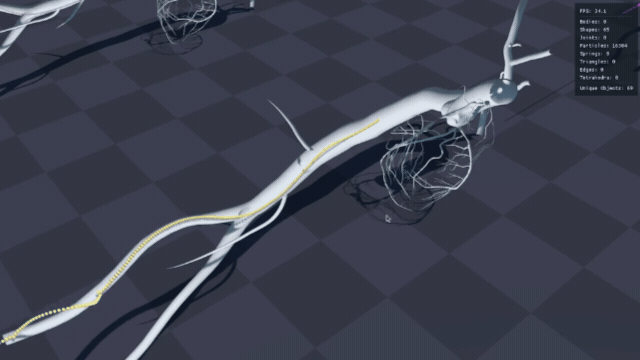 Catheter path highlighted in a 3D vascular model.
