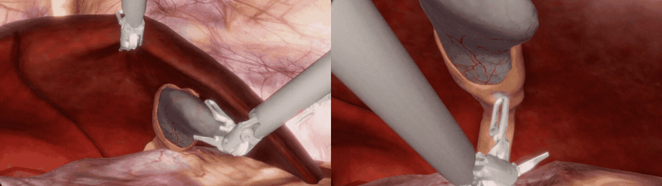 Robotic instruments manipulating simulated abdominal tissue. 