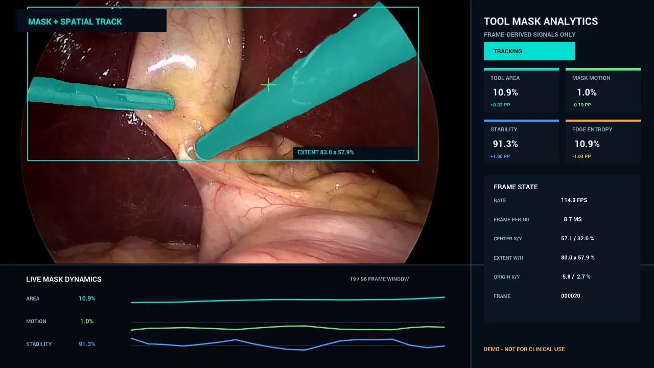 Dashboard screenshot showing an endoscopic surgical feed with a tool segmentation mask and real-time analytics.