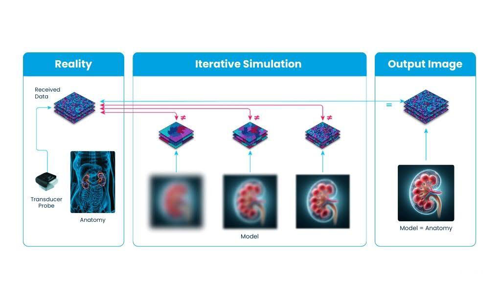 A schematic of the Full Waveform Inversion (FWI) process: an ultrasound transducer captures body anatomy data, which undergoes iterative simulation using cloud-based NVIDIA GPUs to match synthetic models with real-world data, producing an accurate diagnostic image.